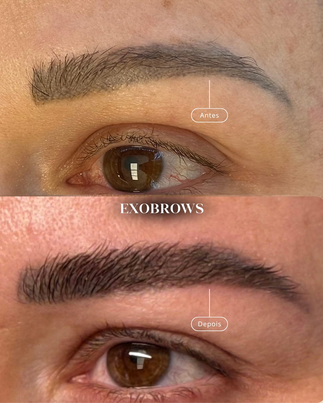 Antes e depois de Regeneração de Sobrancelhas na Traço Fino