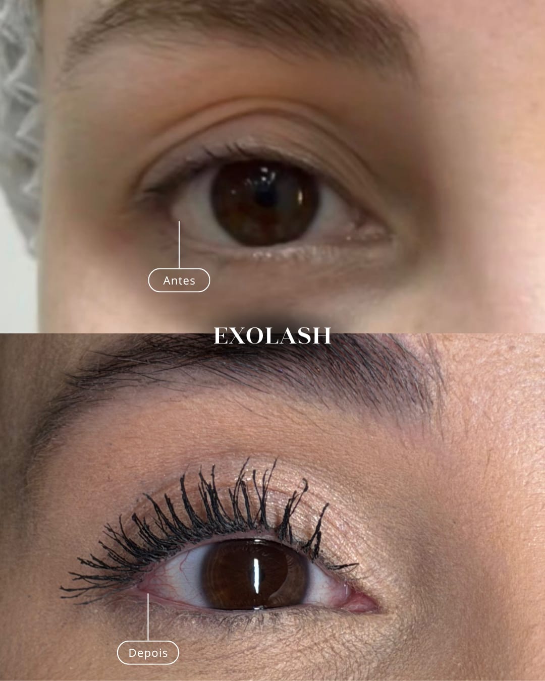 Antes e depois do cuidado de regeneração dos cílios naturais
