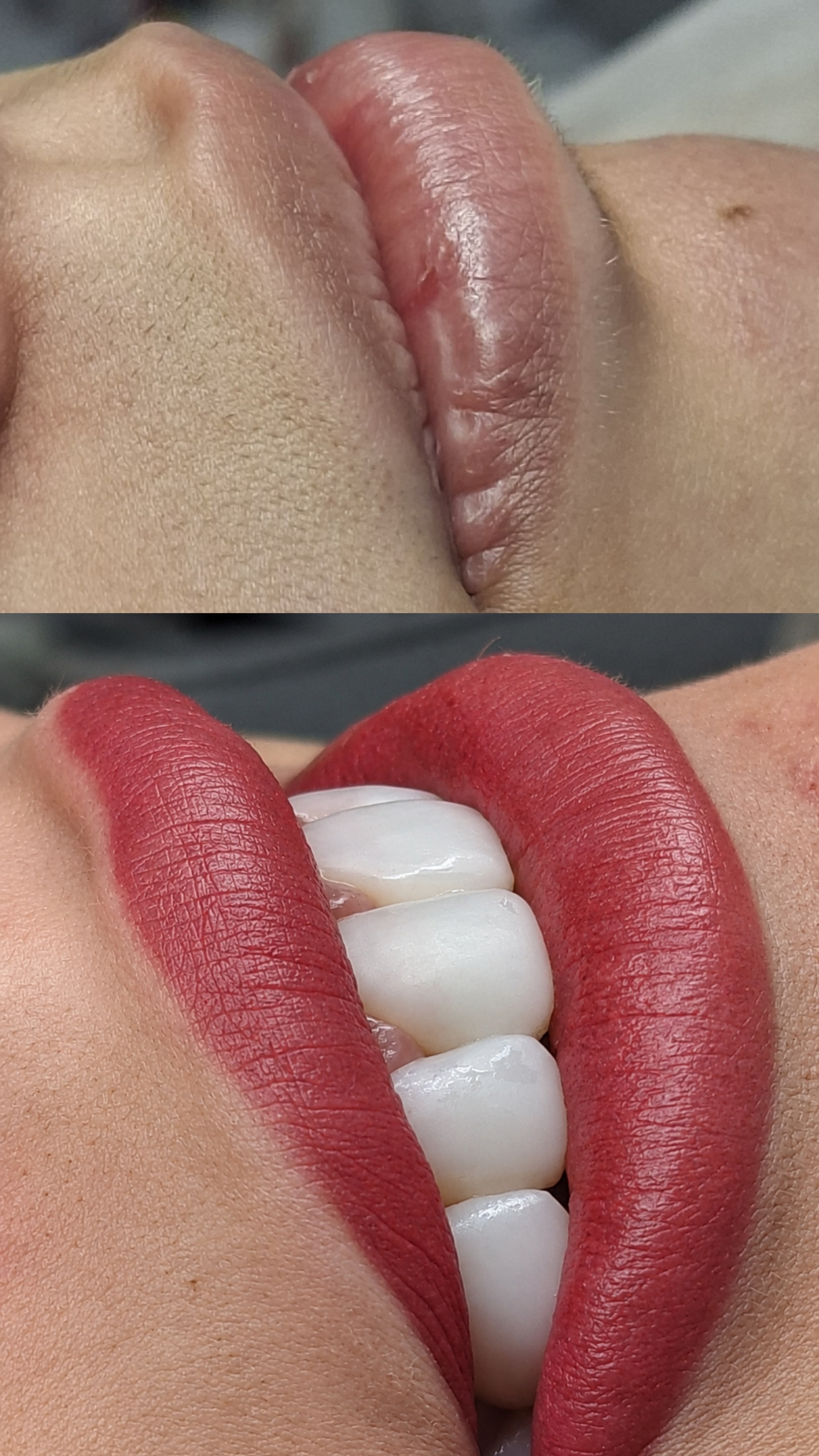Micropigmentação labial com acabamento natural