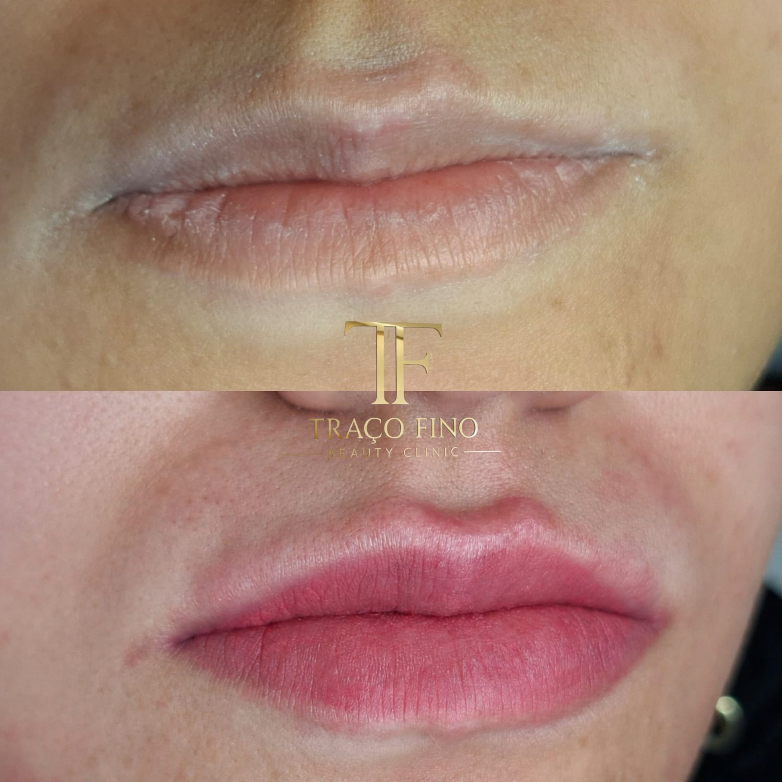 Resultado real de micropigmentação labial na Traço Fino